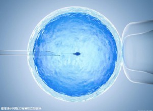 时差成像